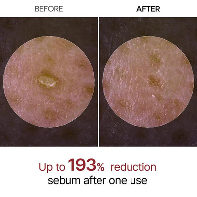 Exfoliating Facial Gel